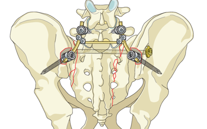 Çanaklygyň zeperlenmeleri we döwükleri